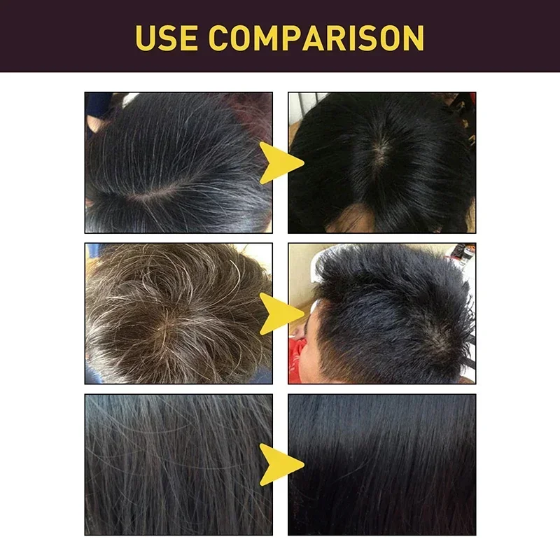 Shampoing 3 en 1 pour teinture - Hair Care Loreal avis et prix